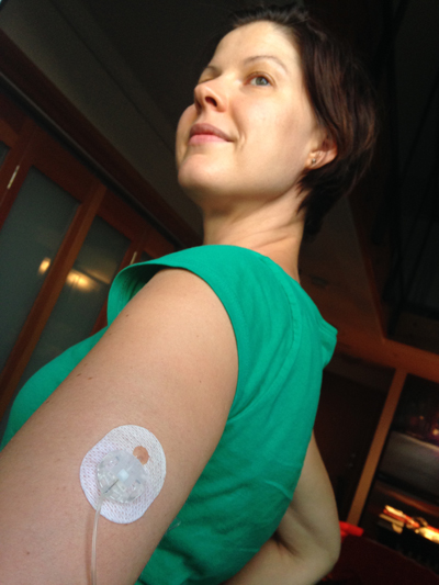 The arm infusion almost always brings out the masses.