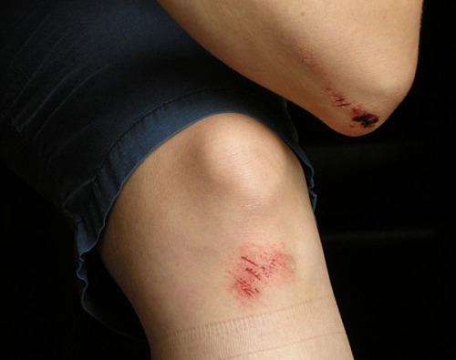 I'd like to press charges.