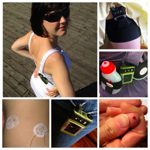 Dear Diabetes: the accessory of my life.