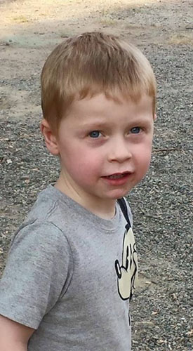 One month post diagnosis - those cheeks!!!