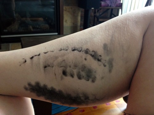 Chain Stain: Running doesn't do this to my legs!